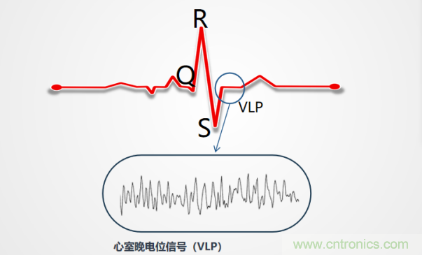 解決心電監測行業難題，曼森伯格的濾波技術獲國家知識產權局發明授權